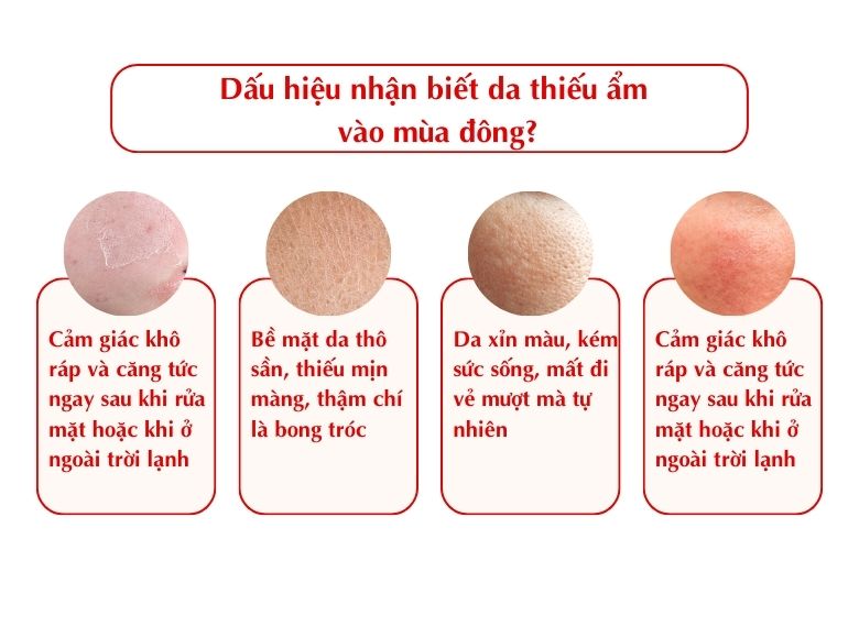 Các dấu hiệu phổ biến của da thiếu ẩm vào mùa đông