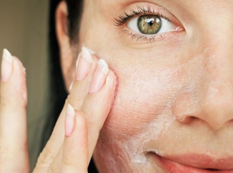 dầu tẩy trang có gây mụn không