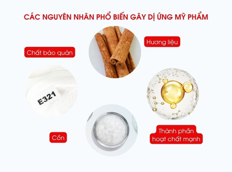 dị ứng mỹ phẩm có tự hết không