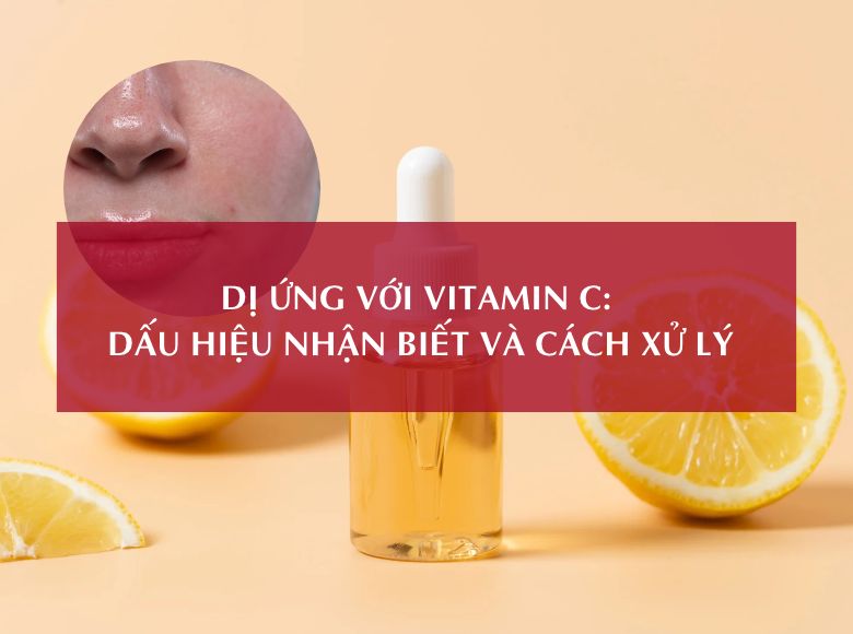 DỊ ỨNG VỚI VITAMIN C: DẤU HIỆU NHẬN BIẾT VÀ CÁCH XỬ LÝ