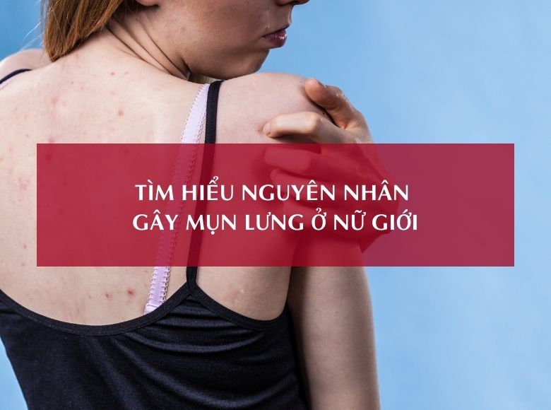 TÌM HIỂU NGUYÊN NHÂN GÂY MỤN LƯNG Ở NỮ GIỚI