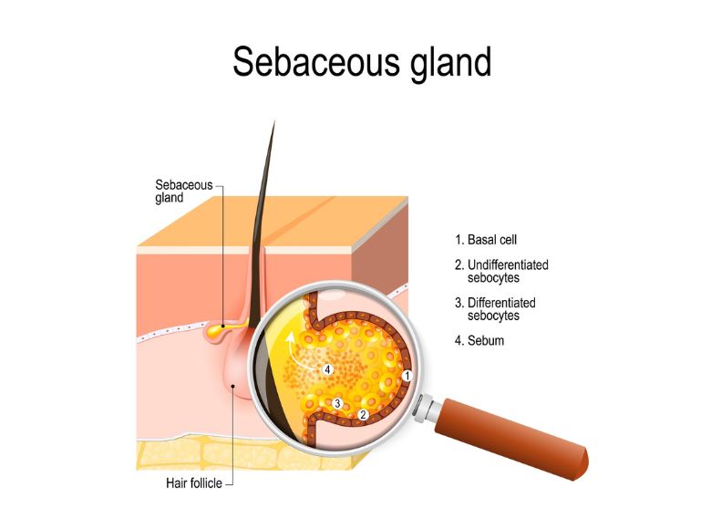 nguyên nhân gây mụn lưng ở nữ giới