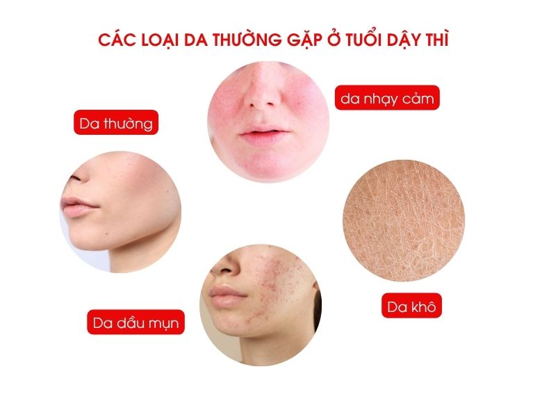 skincare cho tuổi dậy thì cần những gì