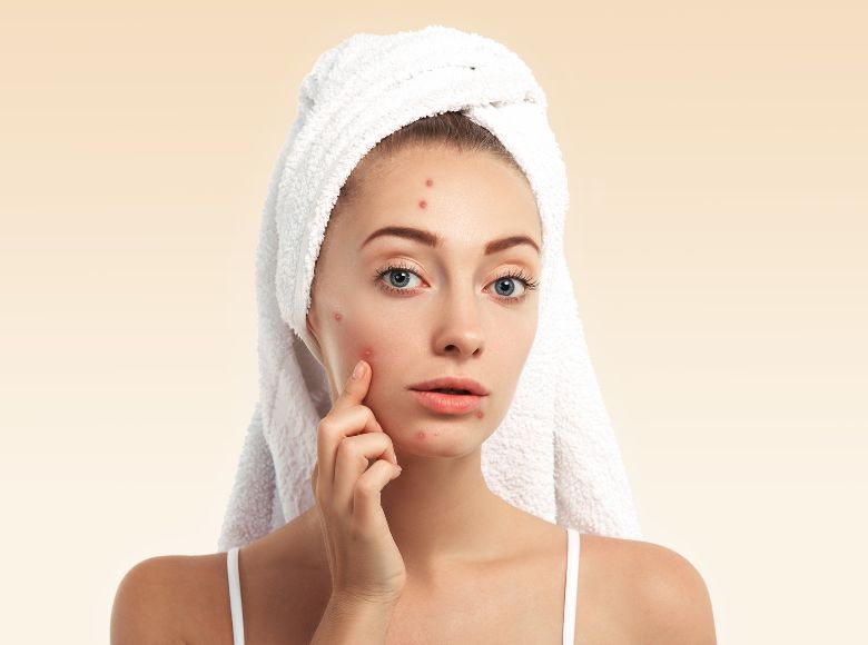 skincare cho tuổi dậy thì cần những gì