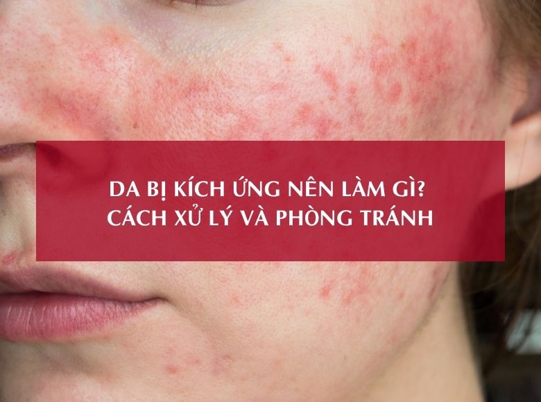 DA BỊ KÍCH ỨNG NÊN LÀM GÌ? CÁCH XỬ LÝ VÀ PHÒNG TRÁNH