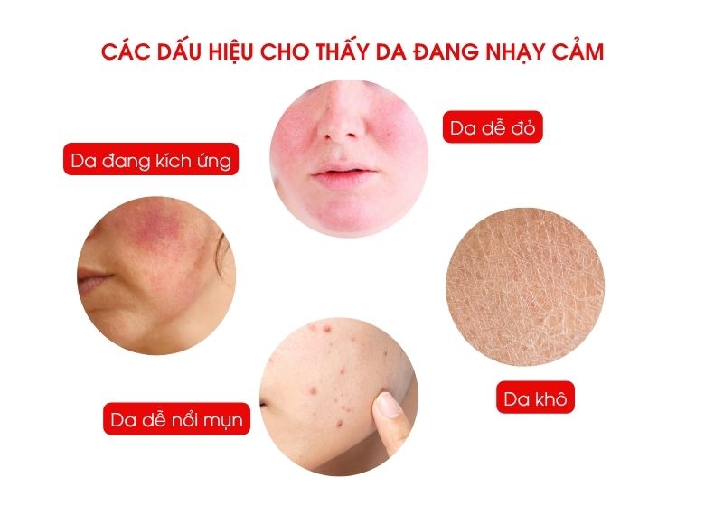 sữa rửa mặt cho da nhạy cảm